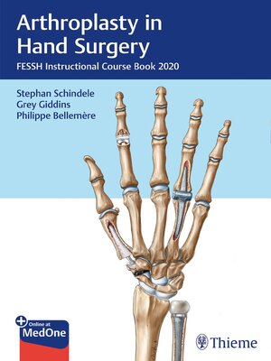 cover image of Arthroplasty in Hand Surgery